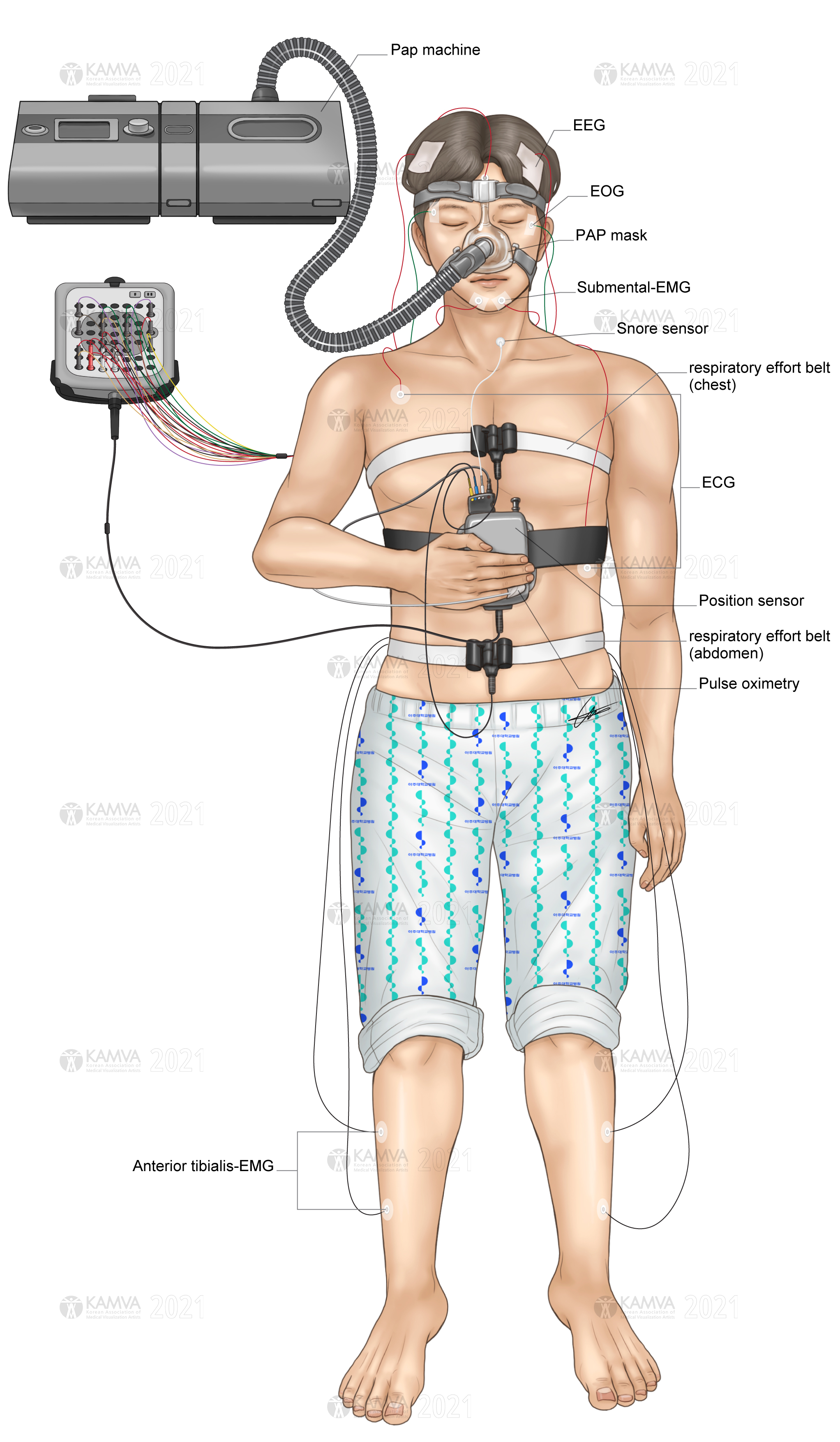 P-조우현_Description of pap machine for breathing.jpg