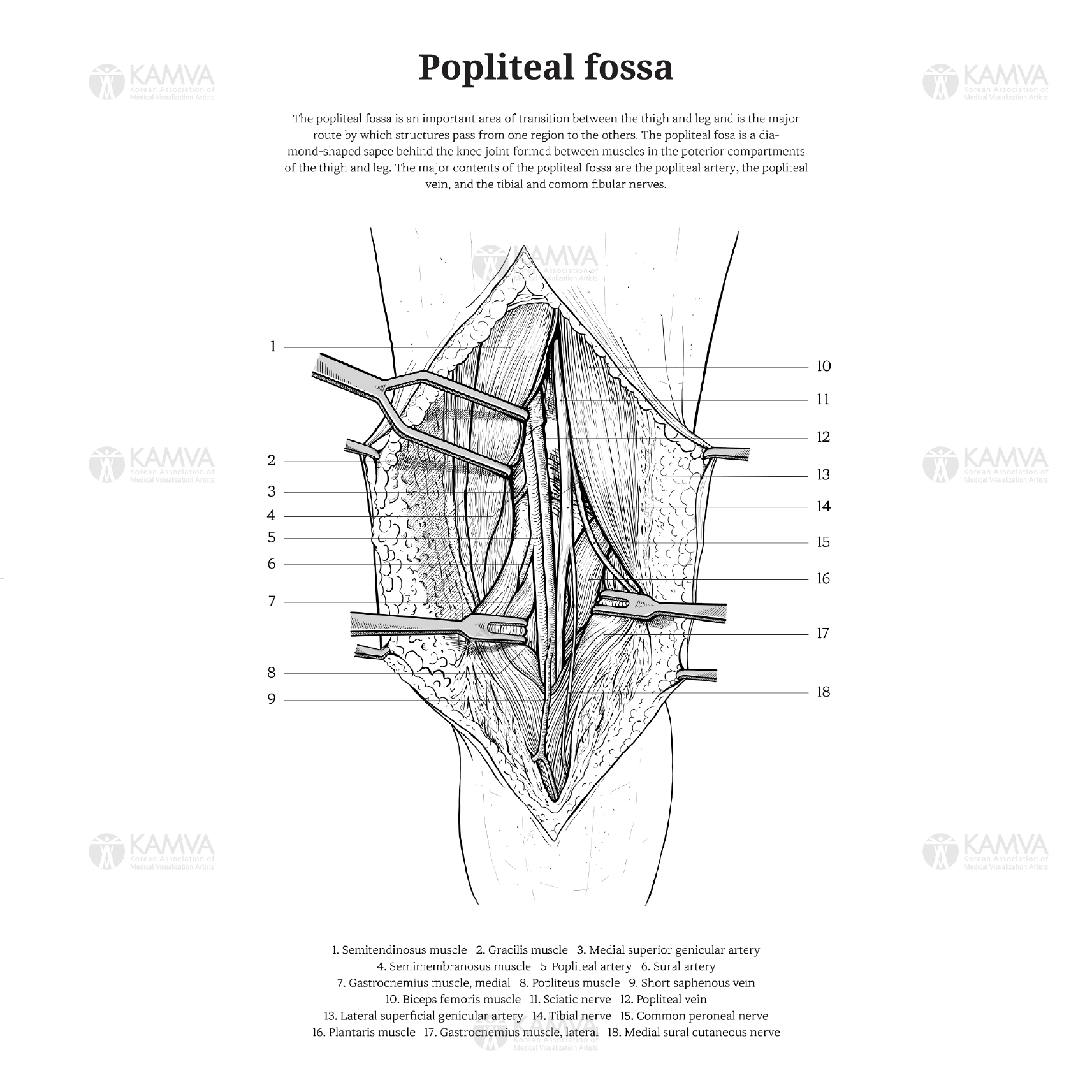 정선미_PoplitealFossa_linedrawing.png